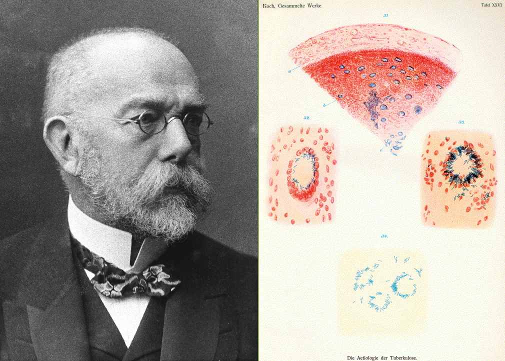 Robert Koch and his drawing of tuberculosis bacilli