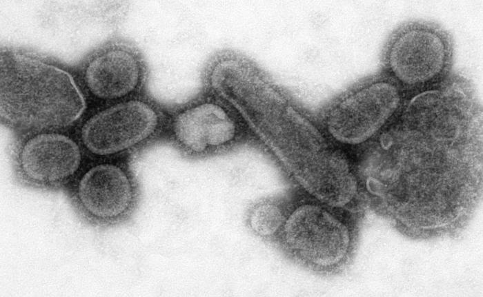 Electron microscope image of influenza virus